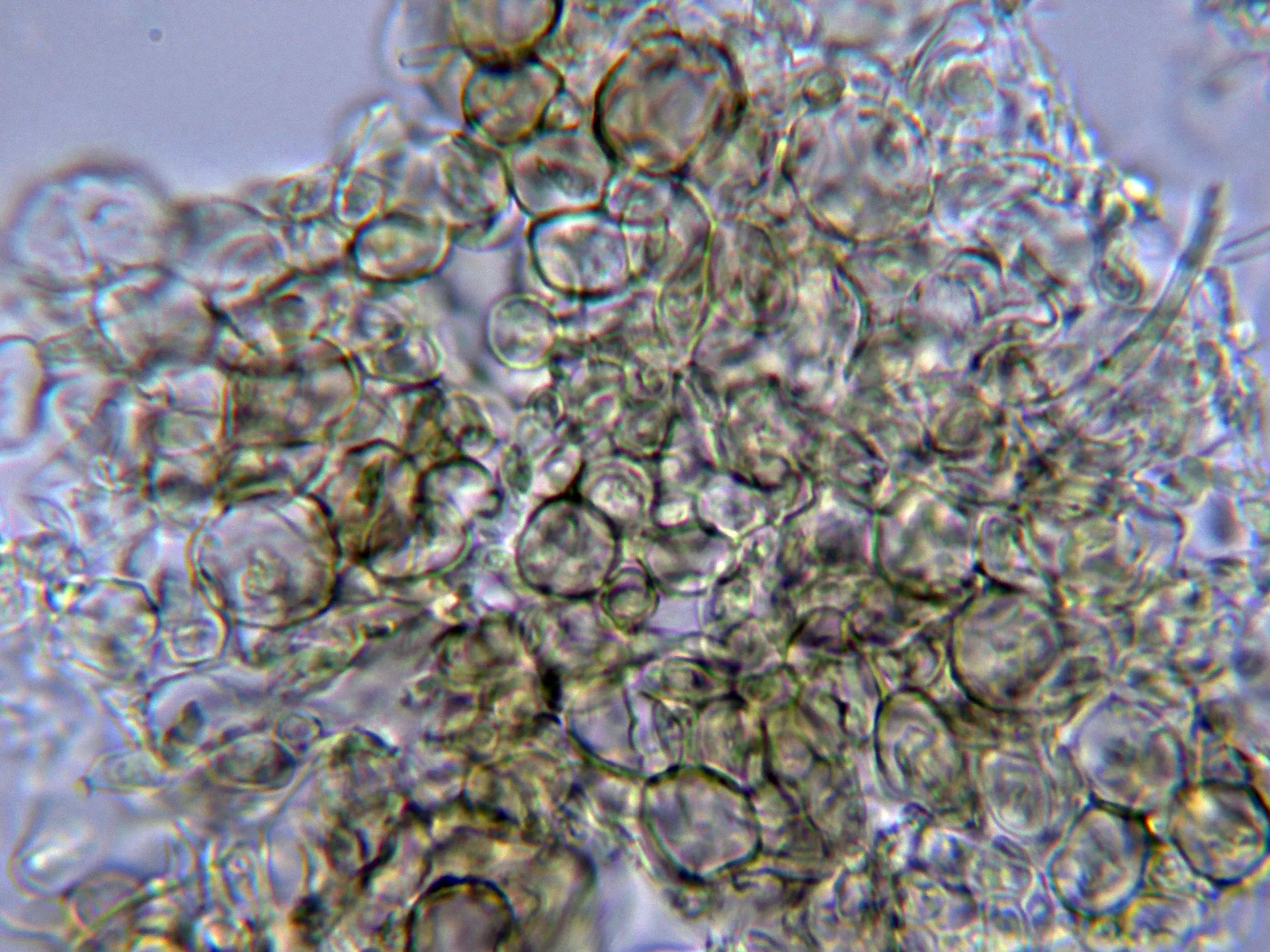 Microscopía de Mollisia cinerea - 10 - Excípulo Melzer-001